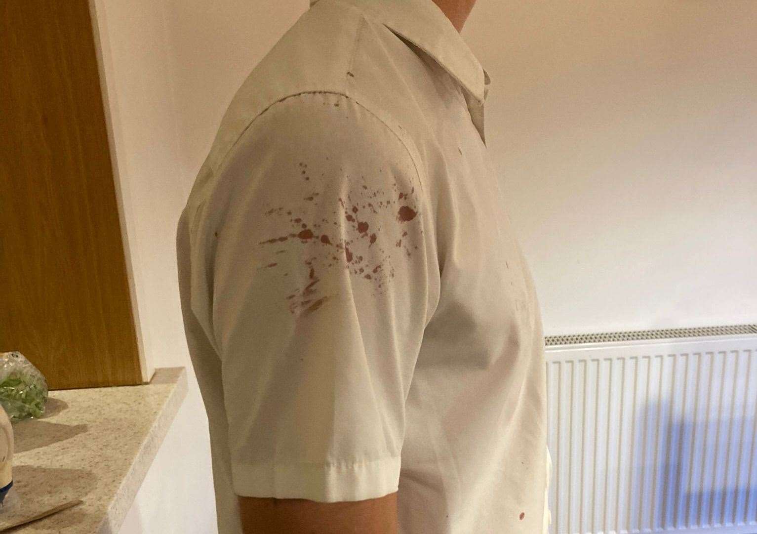 His shirt was splattered in blood following the assault outside the George Inn in Meopham