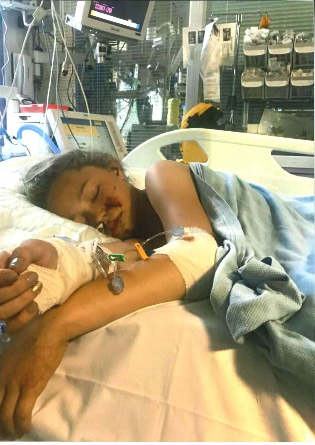Gracie Maddox at King's hospital on life support following a tragic accident on Fleet Estate, Dartford on June 26, 2017. Picture: Caitlin Webb, Local democracy reporter (4147229)