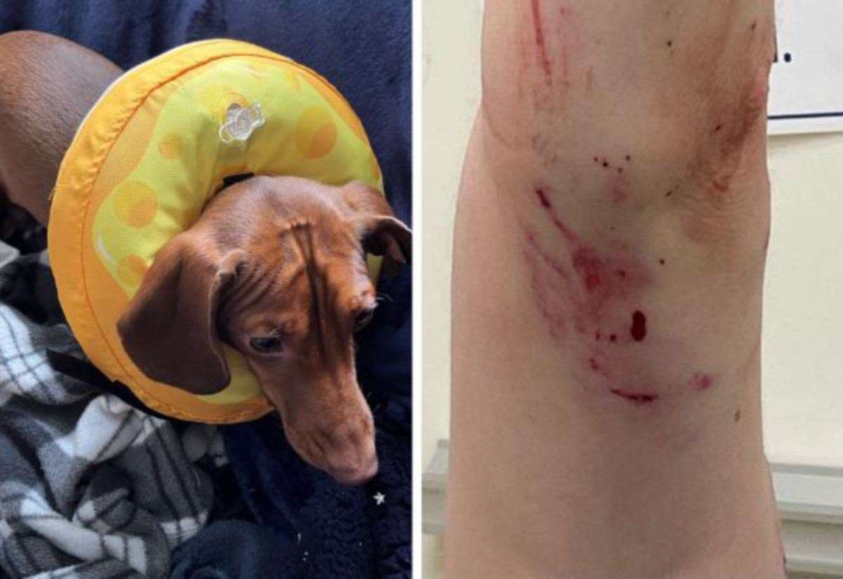 Teenager Hurt Protecting Puppy From Dog Attack in Herne Bay Gardens