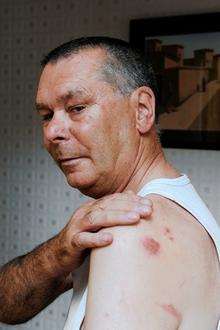 Peter Chandler, 60, of Belmont Road, Halfway, was beaten and robbed
