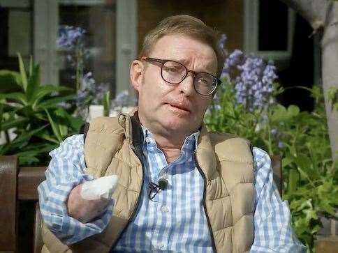 Former South Thanet MP Craig Mackinlay had his arms and legs amputated after a battle with sepsis. Picture: GB News