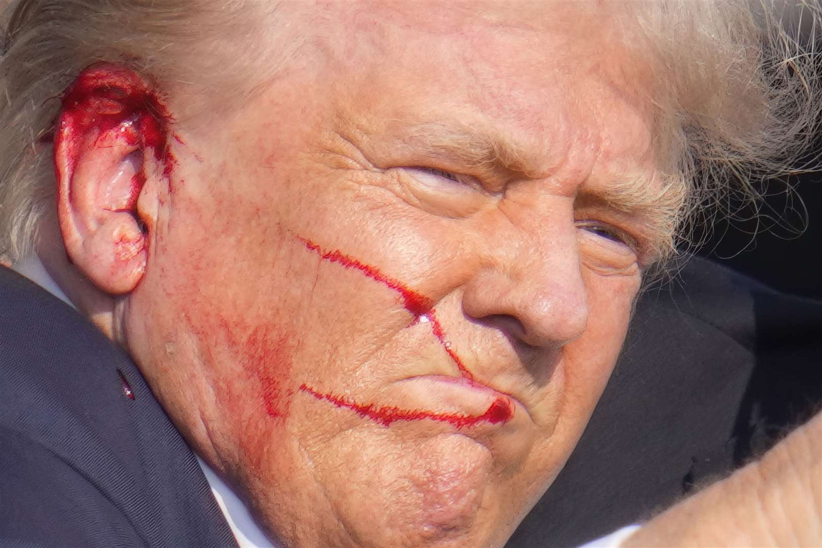 Donald Trump said ‘much bleeding took place’ after a bullet pierced his right ear (Gene J Puskar/AP)