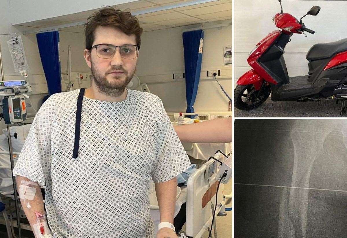 Motorbike crash survivor discovers bike has gone missing from scene at Queenborough after undergoing surgery