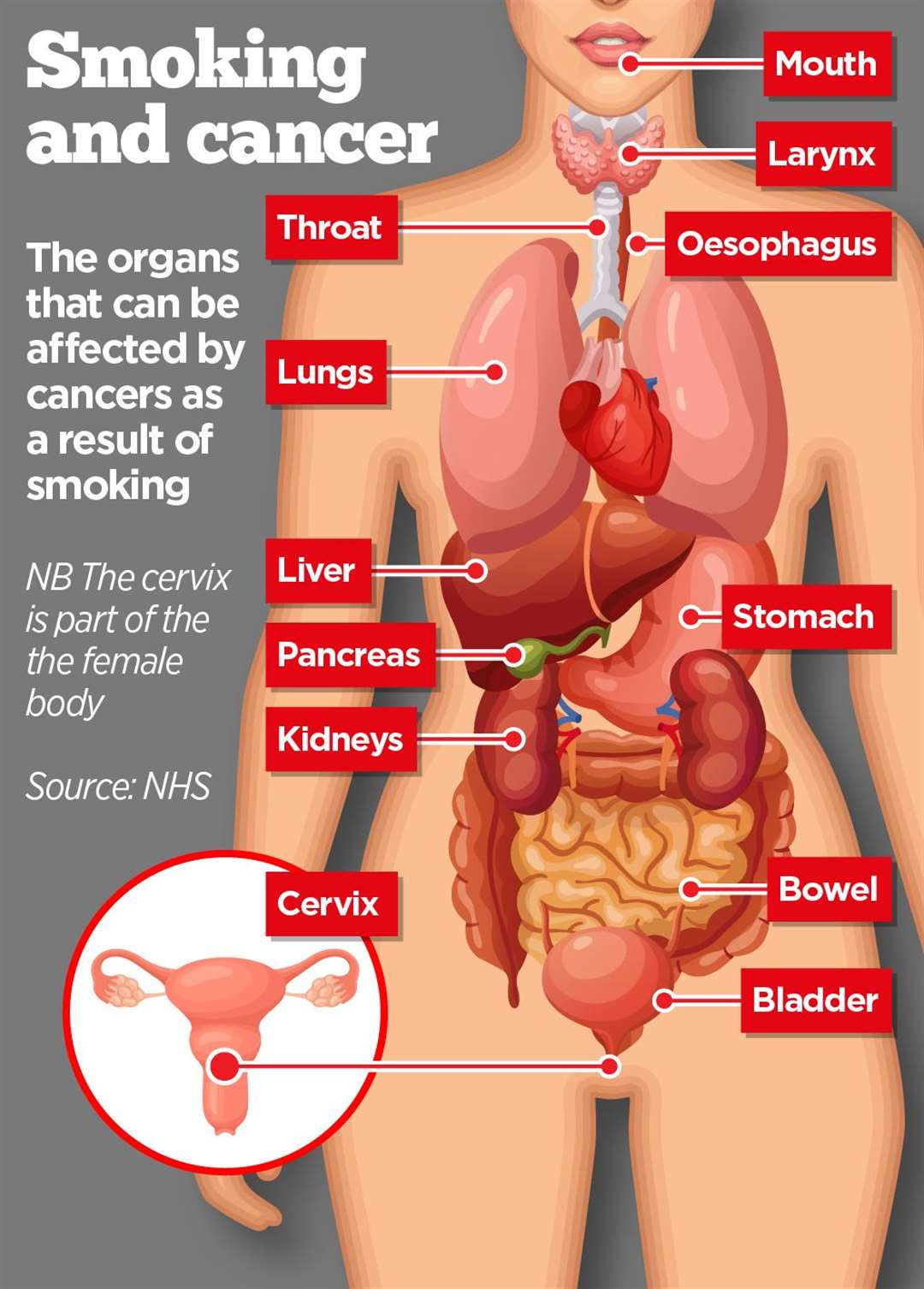 Types of cancer caused by smoking. Source: NHS