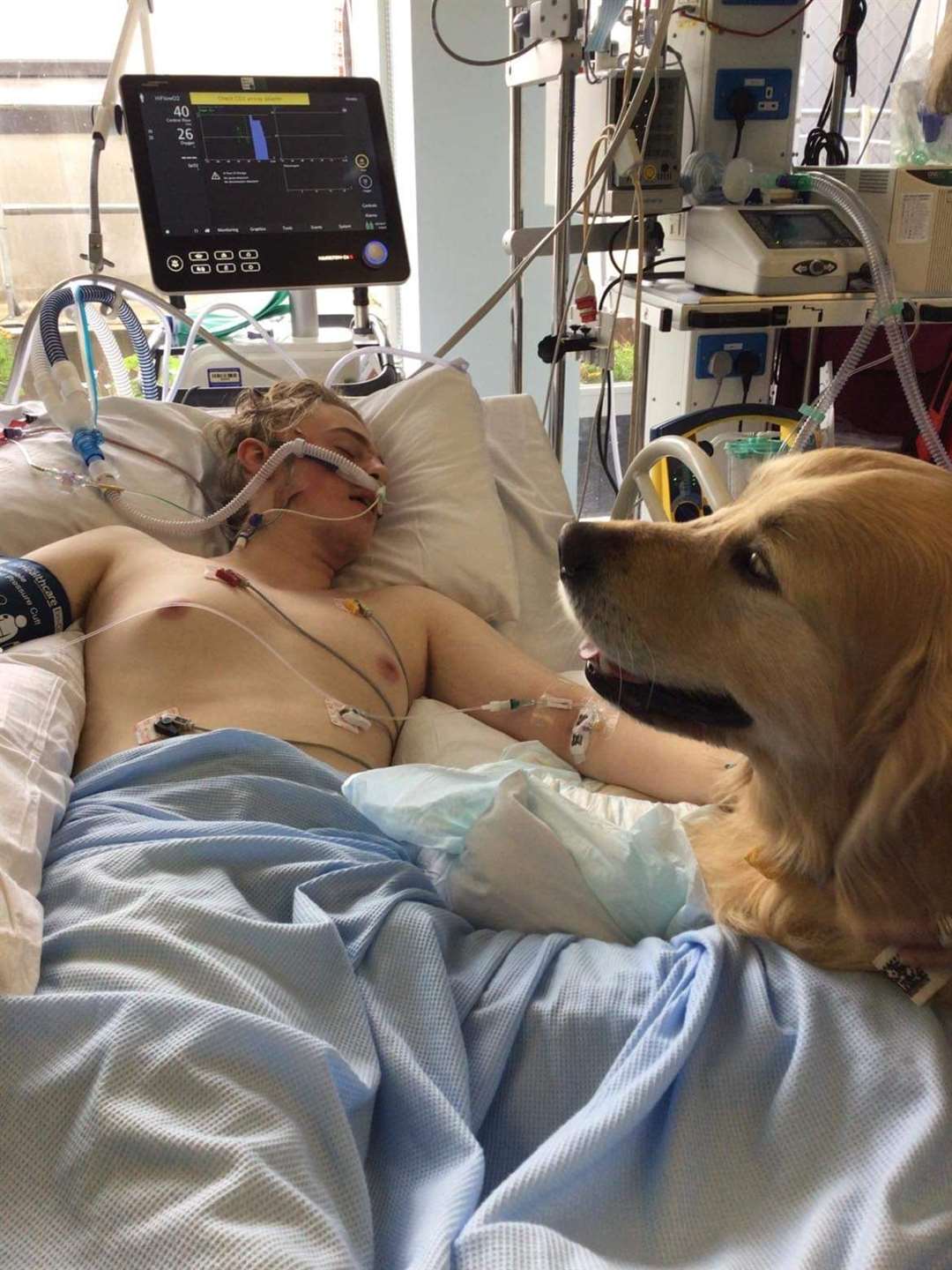 Warrick Allon, 15, after his operation. He made a ‘miraculous’ recovery after he was rushed into emergency surgery at Southampton Children’s Hospital (University Hospital Southampton/PA)