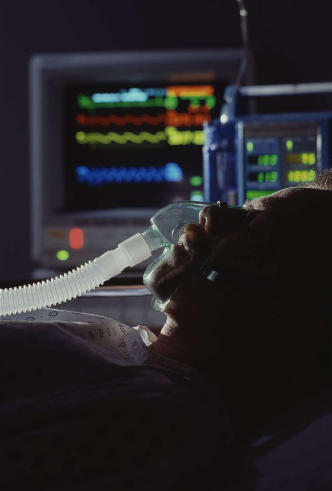 Kelly was in a coma and needed a ventilator to live. Picture: Stock Image