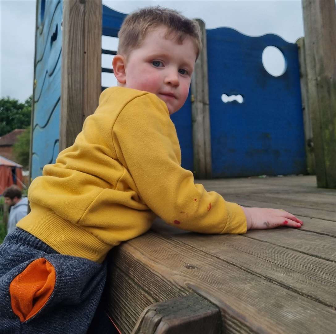 Jacob suffers from four different defects. Picture: Shona Boyle