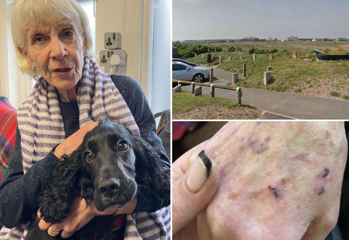 Grandmother injured as puppy attacked by two dogs near Sandown Castle site, Deal