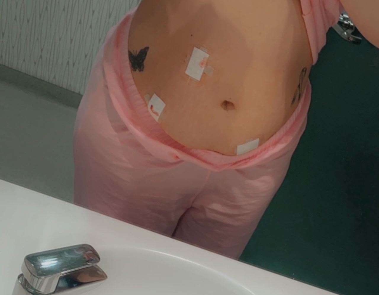 The 27-year-old says she has had more than five surgeries. Picture: Amy Simkins