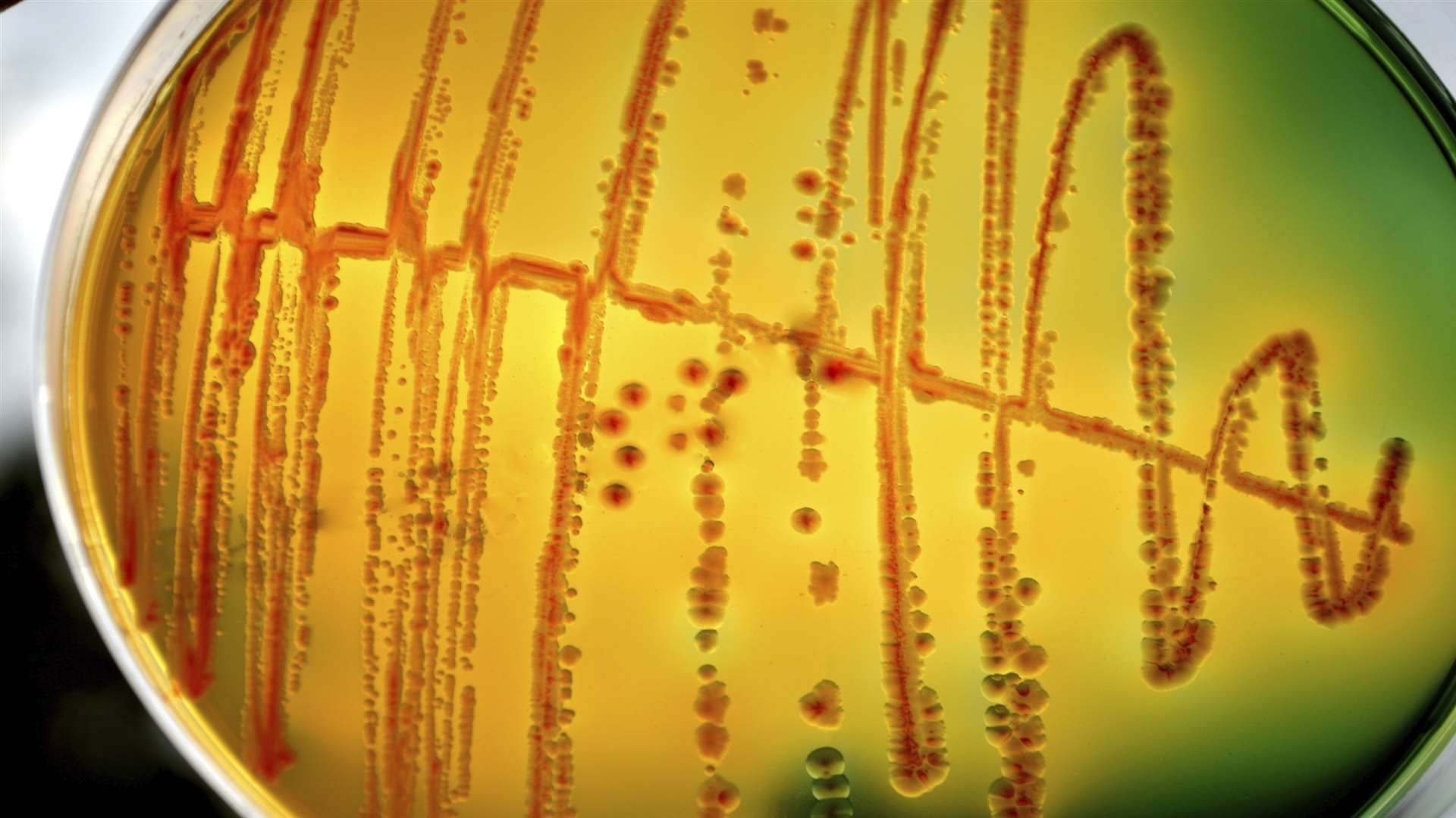 E.Coli bacteria under a microscope. Stock image
