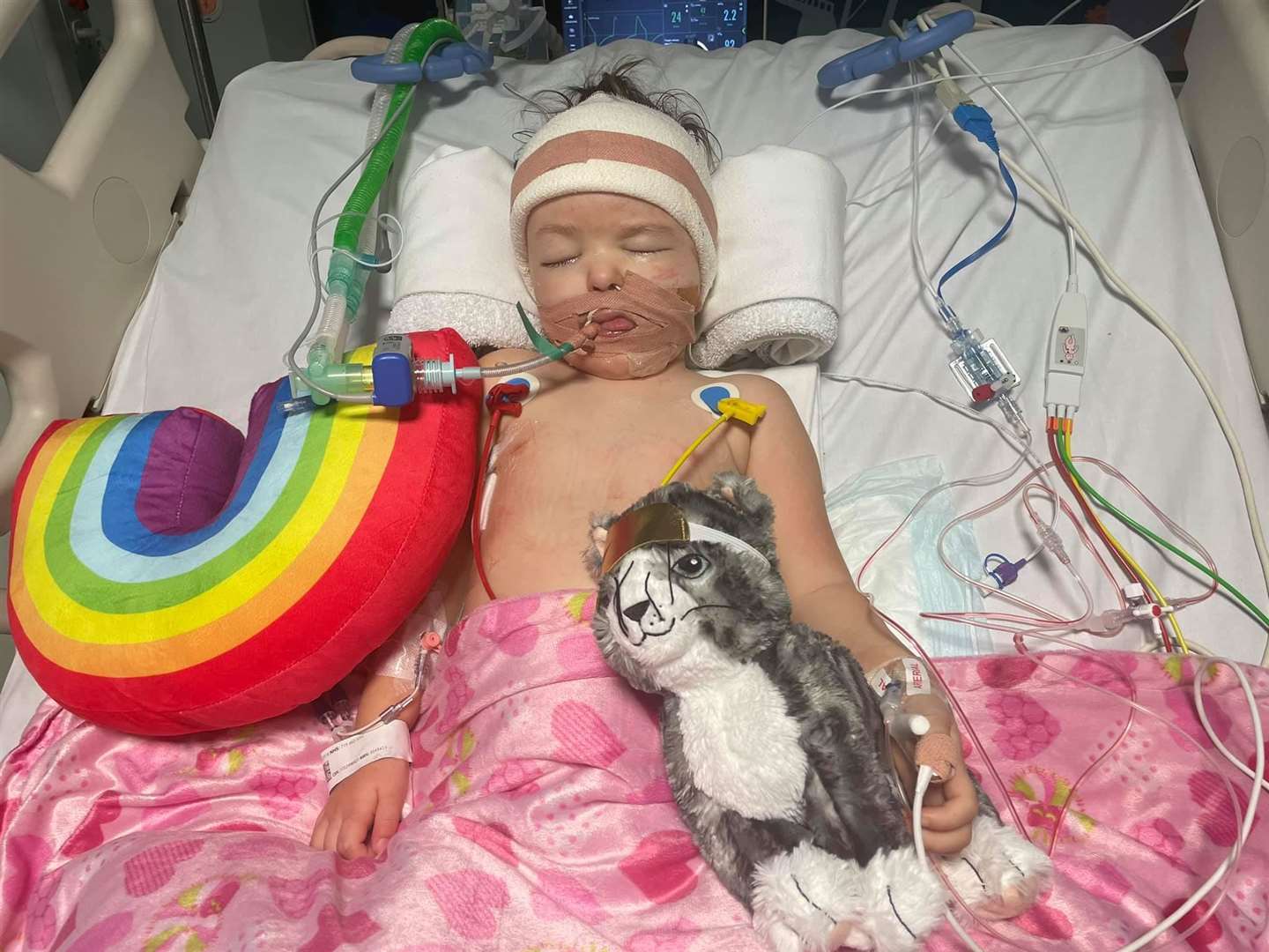 Izzy has been placed on a ventilator for support. Photo: Isobel's Army Facebook Page