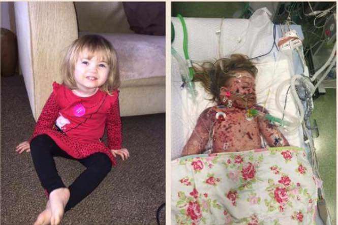 Faye Burdett died from meningitis on Valentine's Day