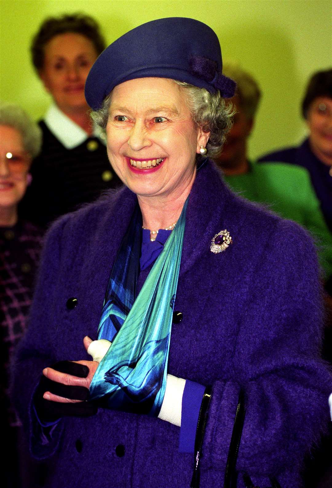 The Queen with her arm in a sling after she was injured as she fell from a horse in 1994 (Fiona Hanson/PA)