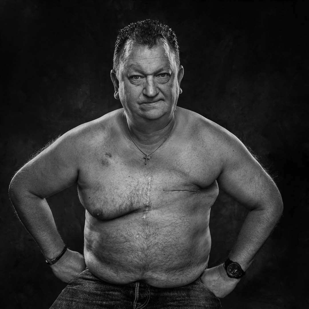 Imelda Bell's portraits of cancer patients. Pictured is Stuart who also had breast cancer