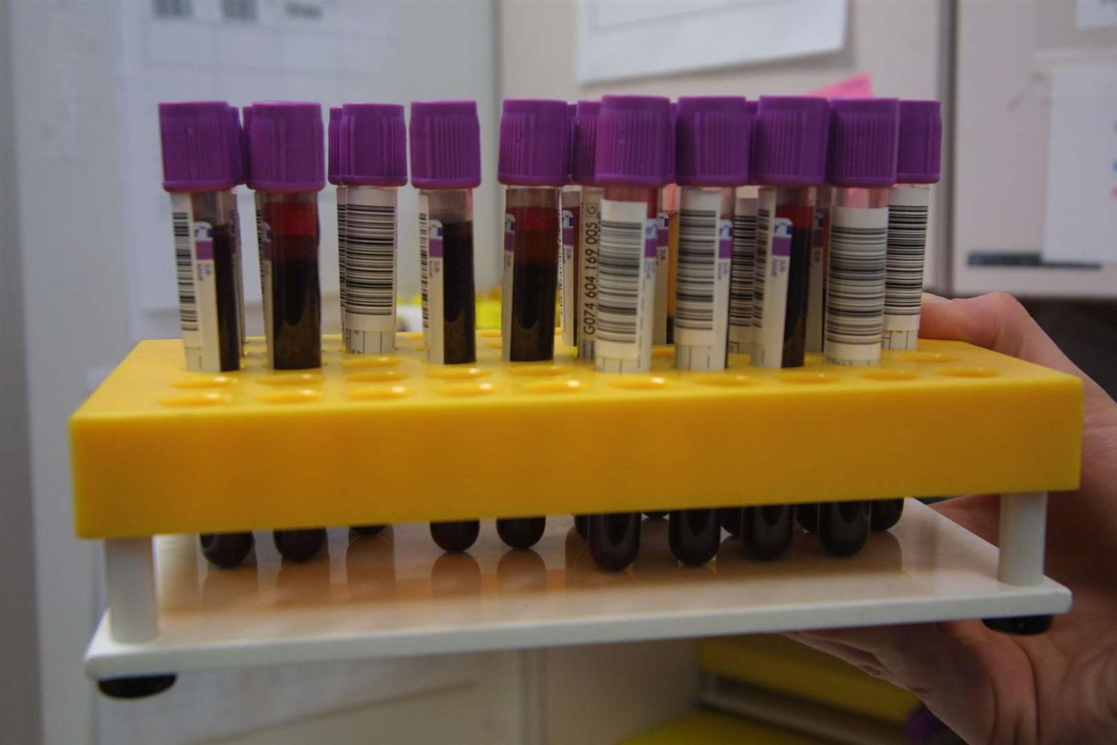 Blood samples