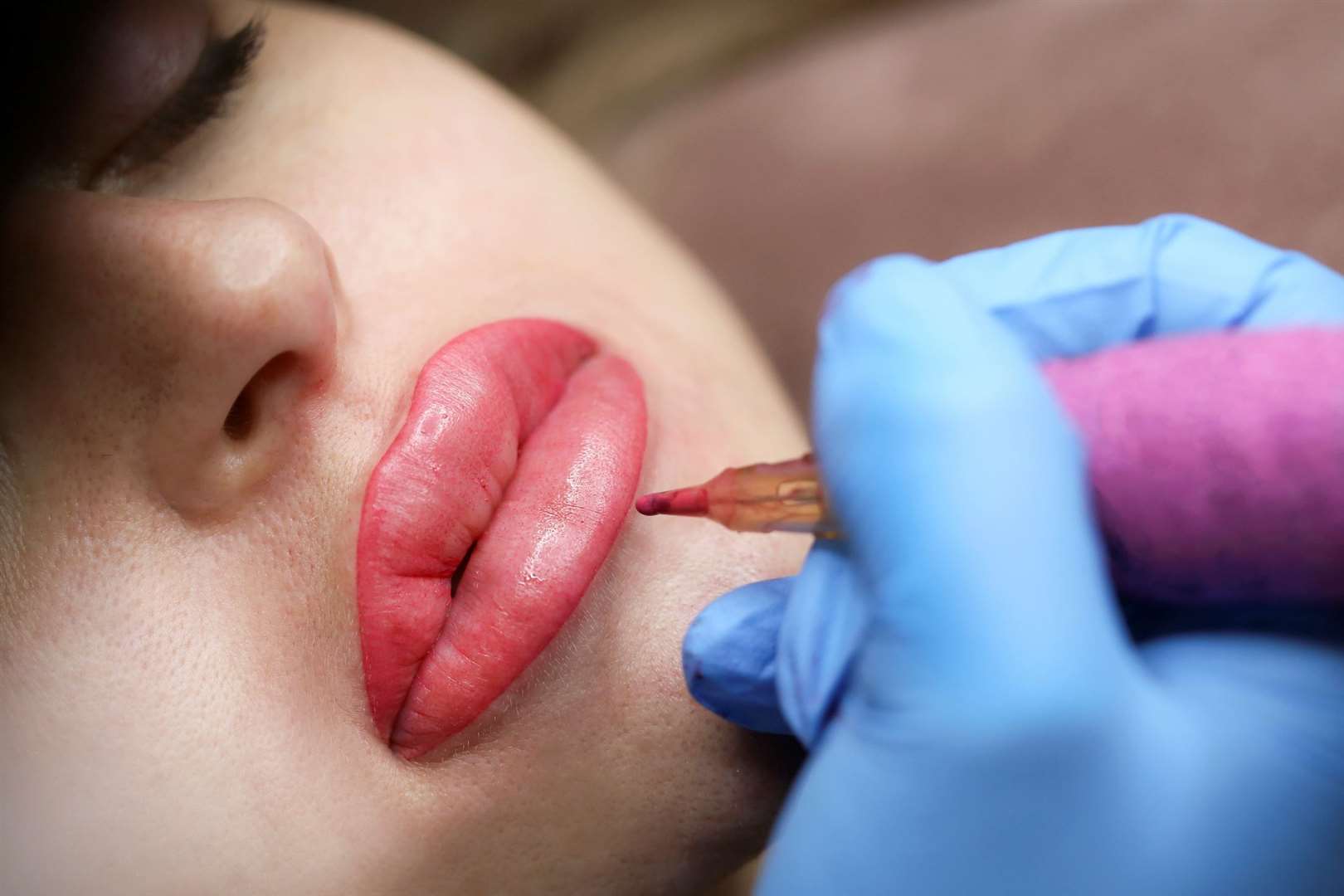 Secret Thinker has questioned the current obsession with over-inflated lips. Picture: iStock