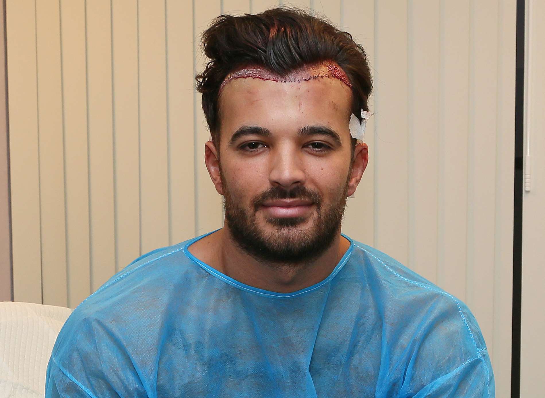 Michael Hassini from TOWIE visited the KSL clinic in Maidstone to undergo a hair transplant