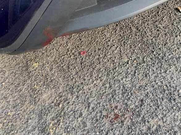 Blood was splattered in the road after the dog fight in Arlington, Ashford
