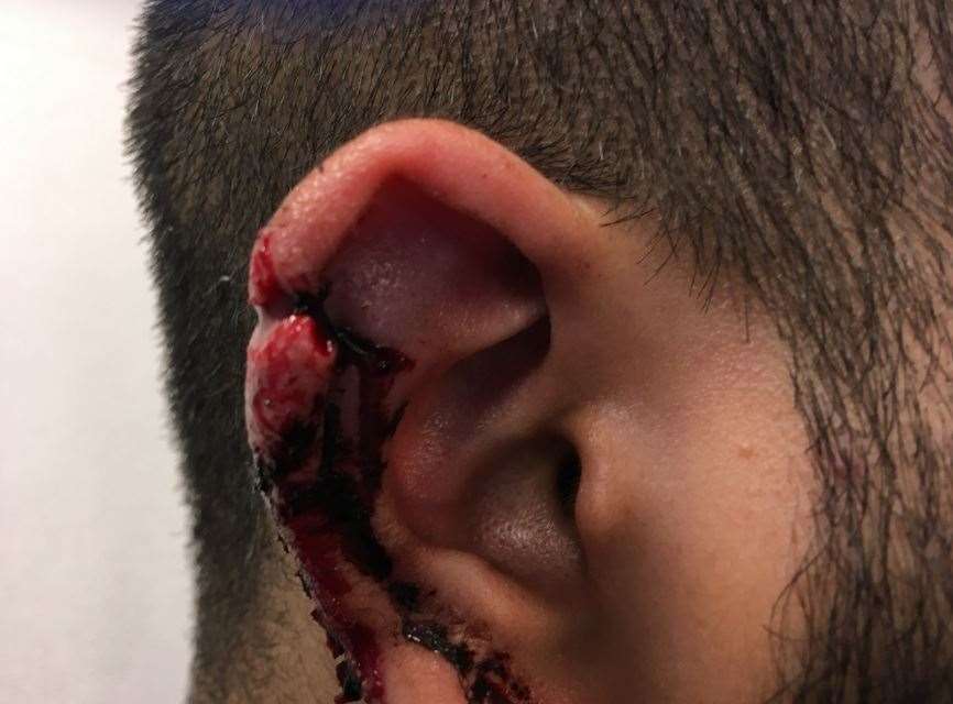 A 19-year-old’s ear was sliced by the weapon (Metropolitan Police/PA)