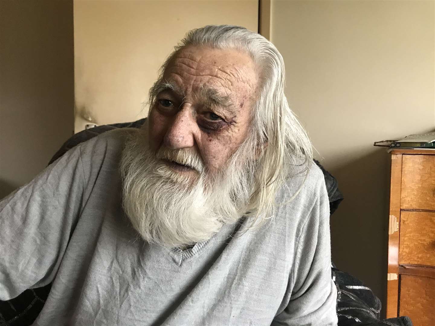 Arthur Chew from Minster, Sheppey, after he was attacked and robbed in his own home in October 2020. Picture: Chloe Holmwood