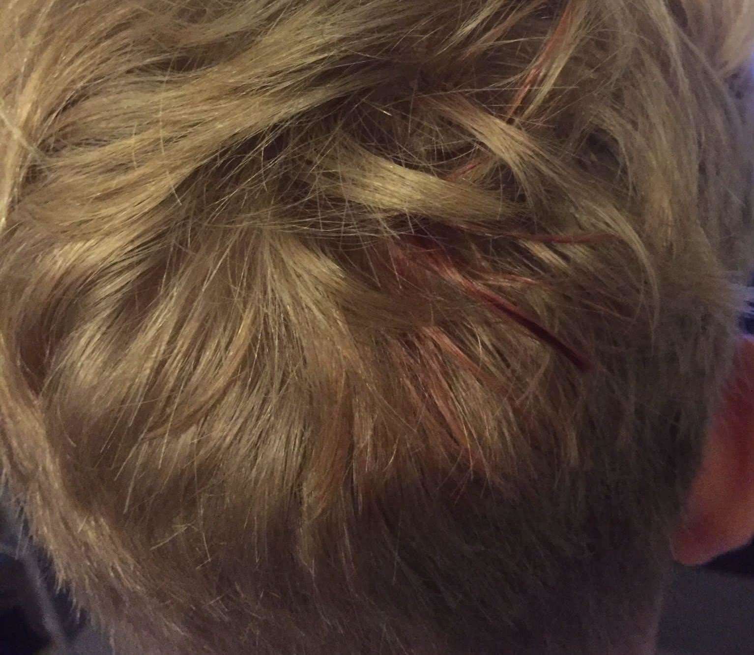 An 11-year-old was left bleeding after a rock was thrown at his head at a bus stop. Picture: Debbie-ann Griffiths