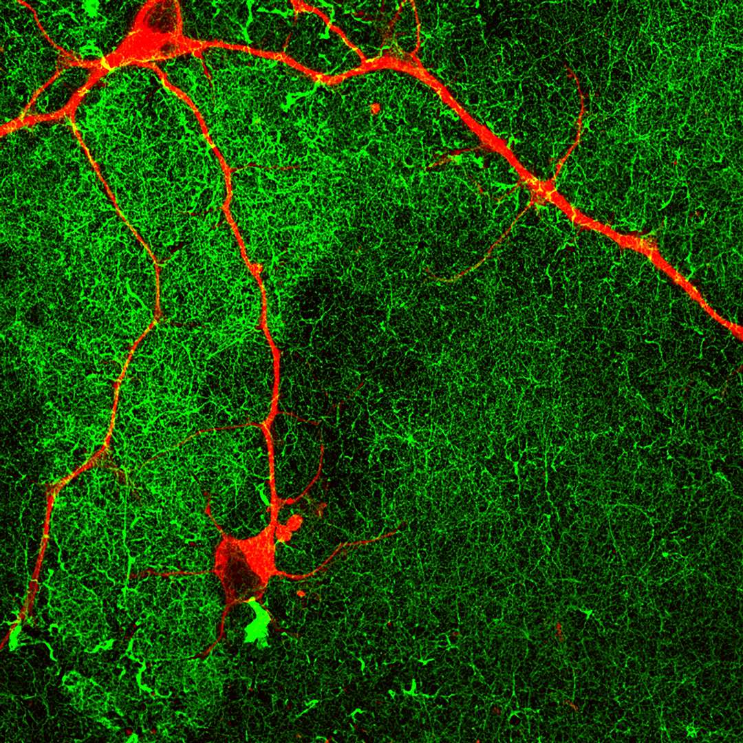 lab-grown-nerve-cells-holds-promise-for-neurodegenerative-disease