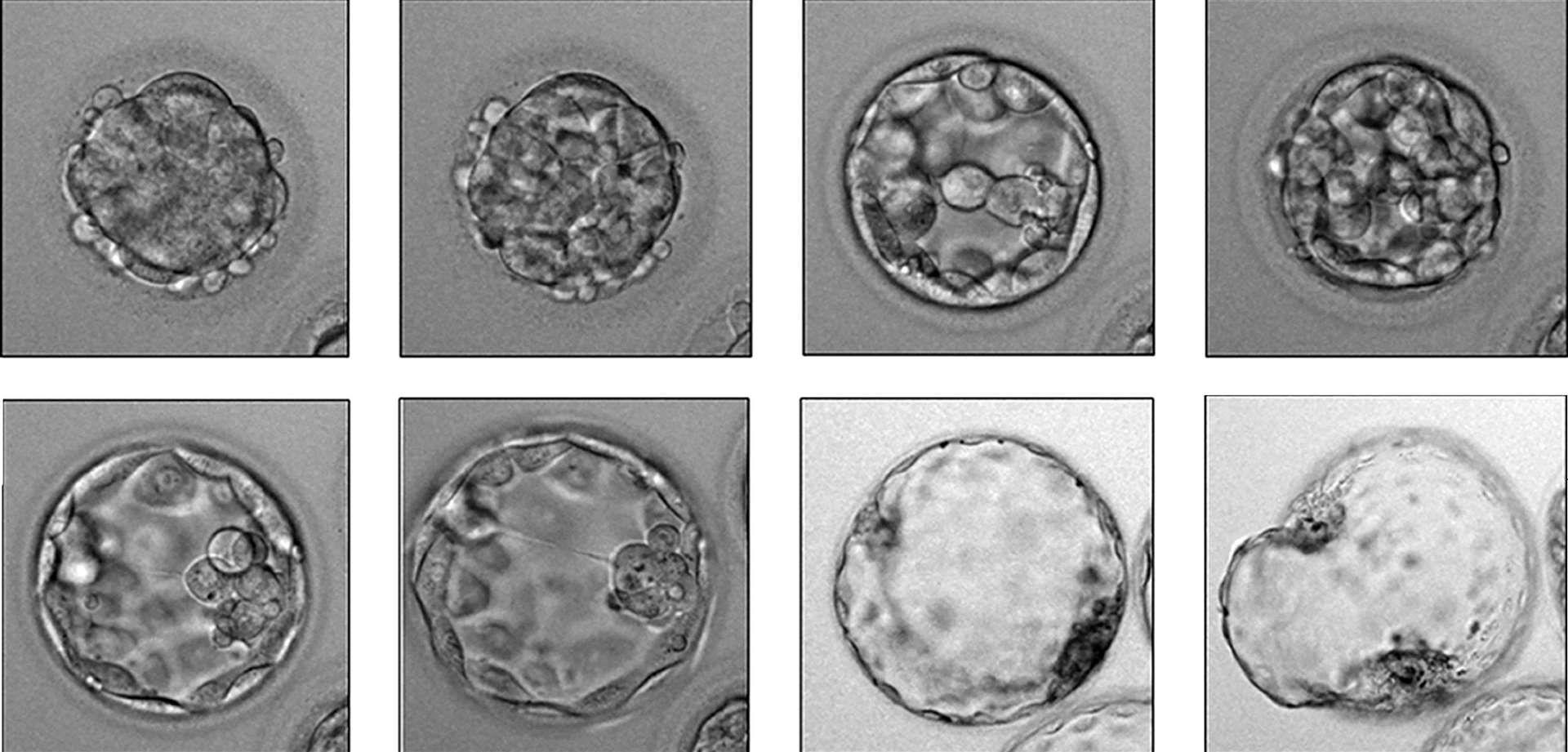 Time lapse images showing an early embryo (Mio Fertility clinic/PA)