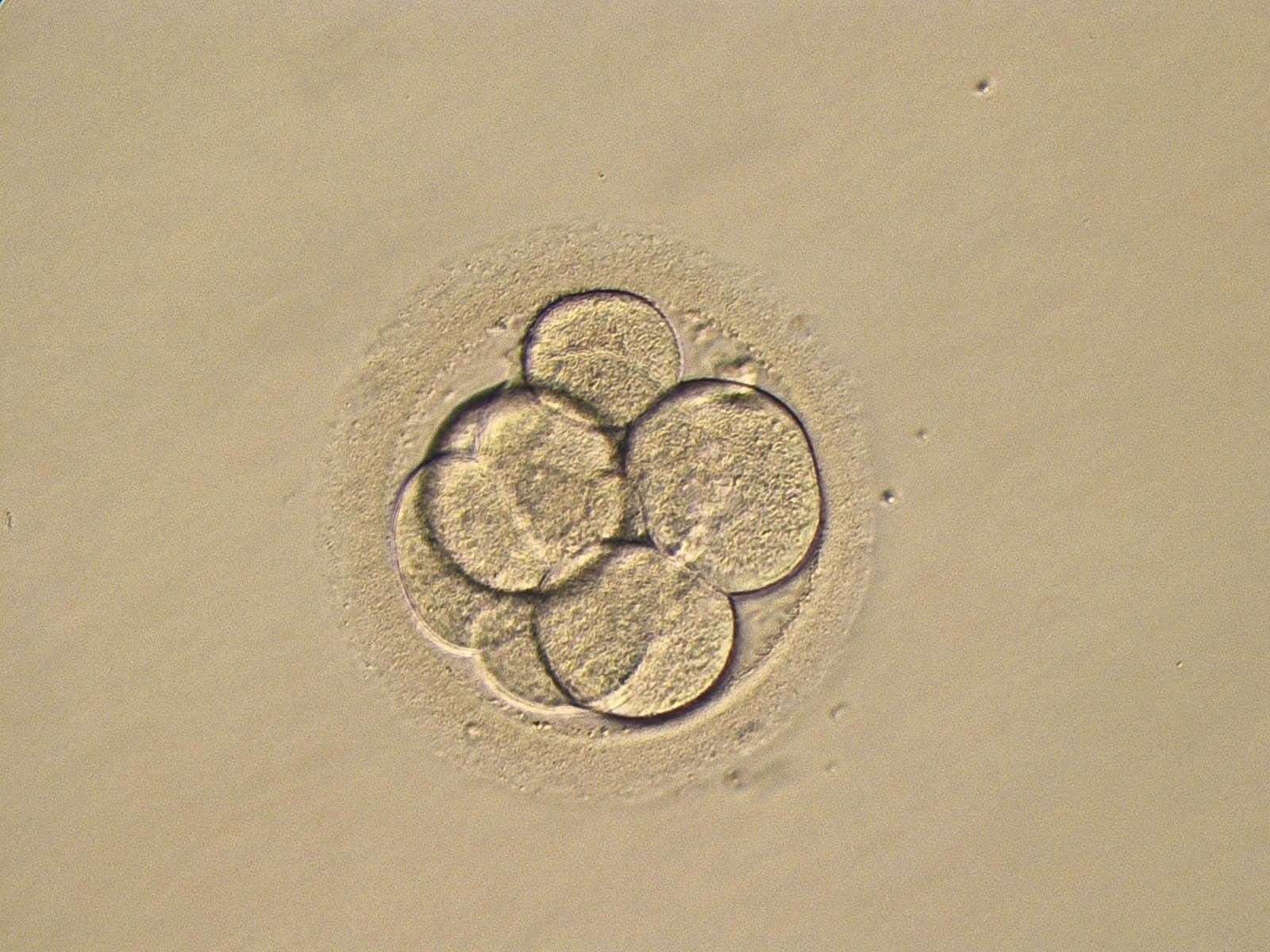 A three-day-old human embryo (PA)