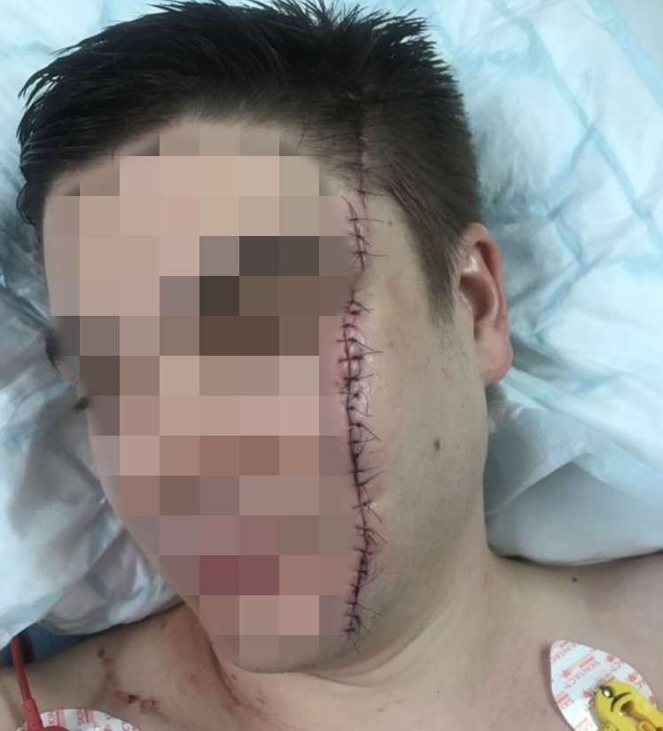 A man had his face slashed in the Prince of Wales pub.
