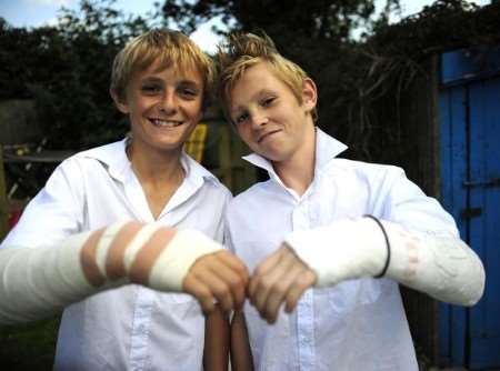 Brothers Sean and Luke Webber compare their broken arms