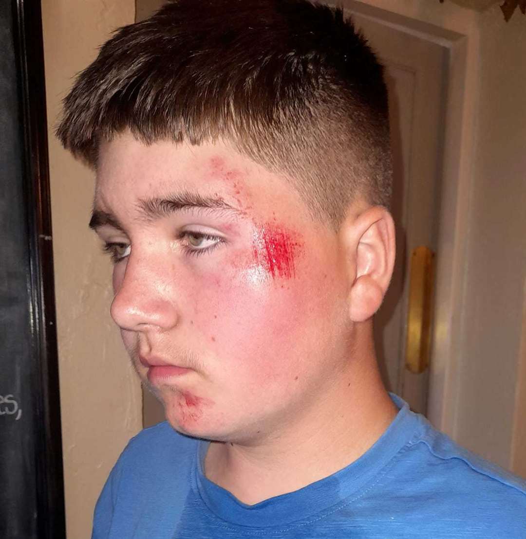 William Johnston, 14, was swerved at by a biker as he cycled along Reculver Lane in Herne Bay. Picture: Michele Rowan