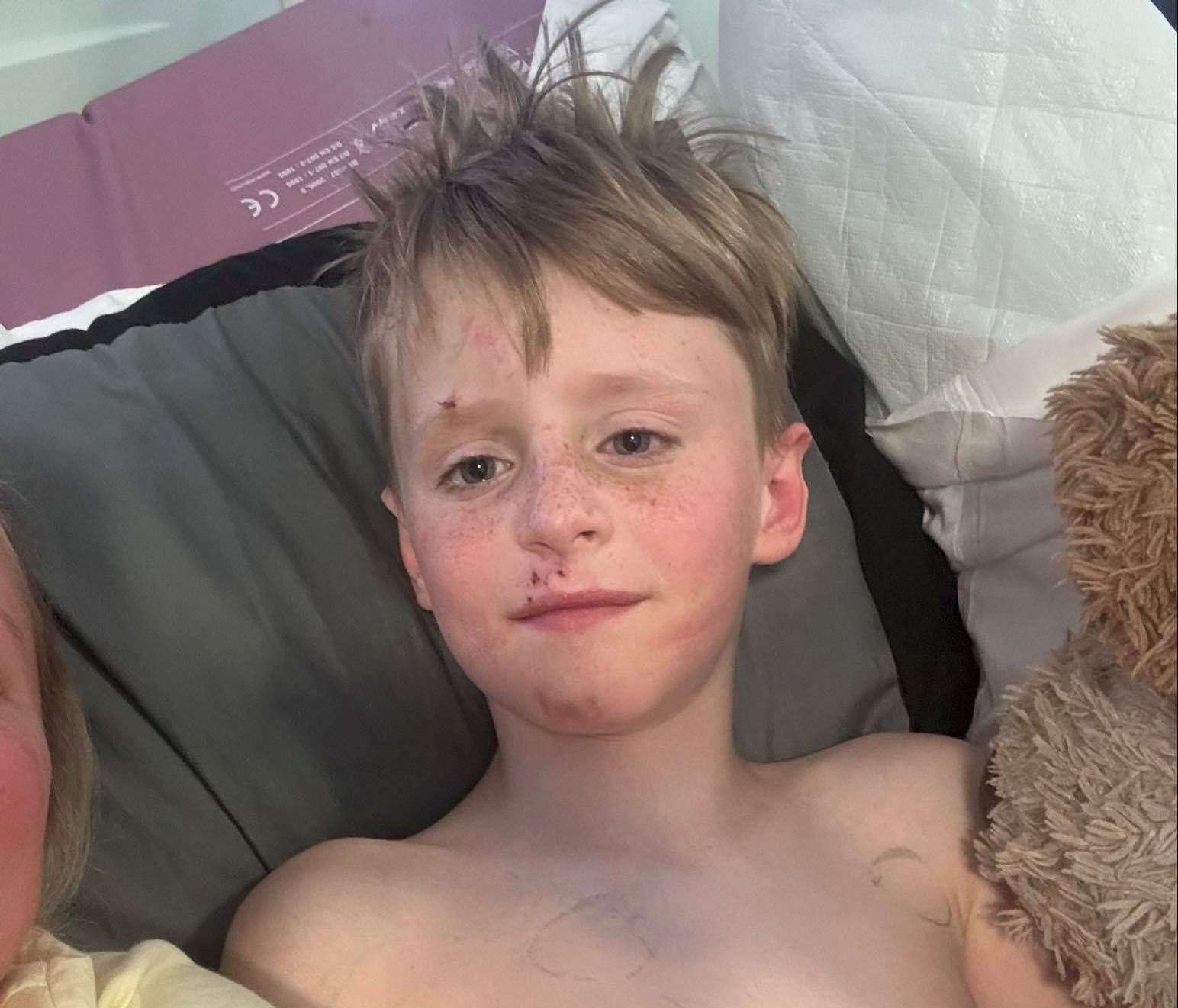 Harrison Sahlah, from Sandgate, Folkestone, is awake and making good progress in hospital. Picture: Kelly Sahlah