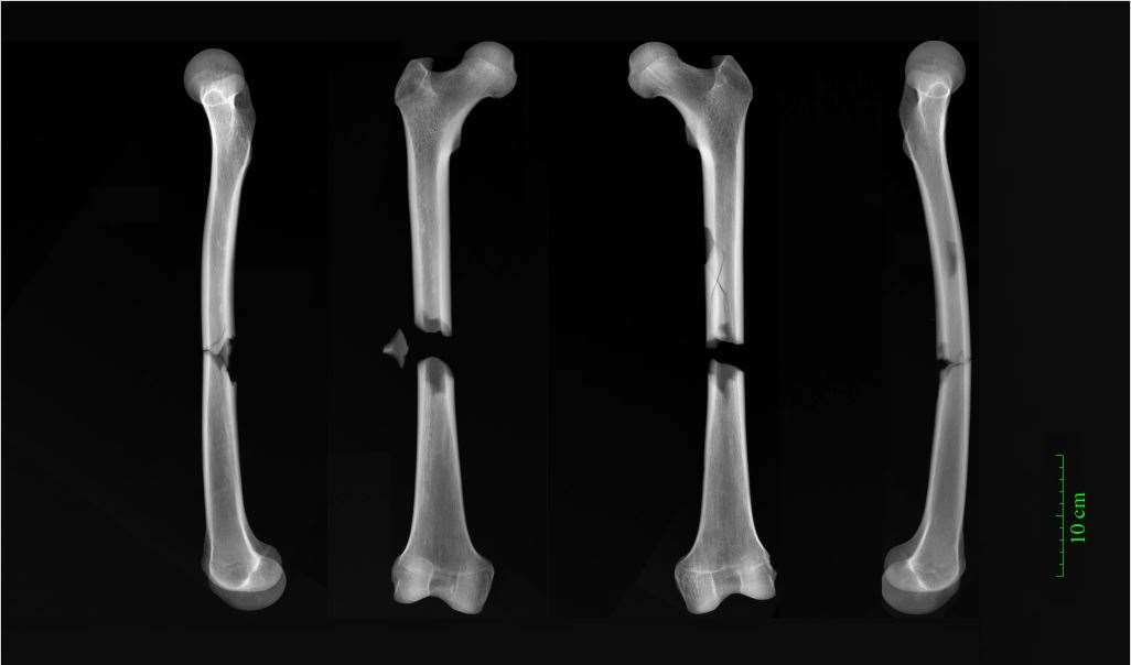 X-rays of butterfly fractures to both femora of an adult male buried in the Augustinian friary (Dr Jenna Dittmar/PA)