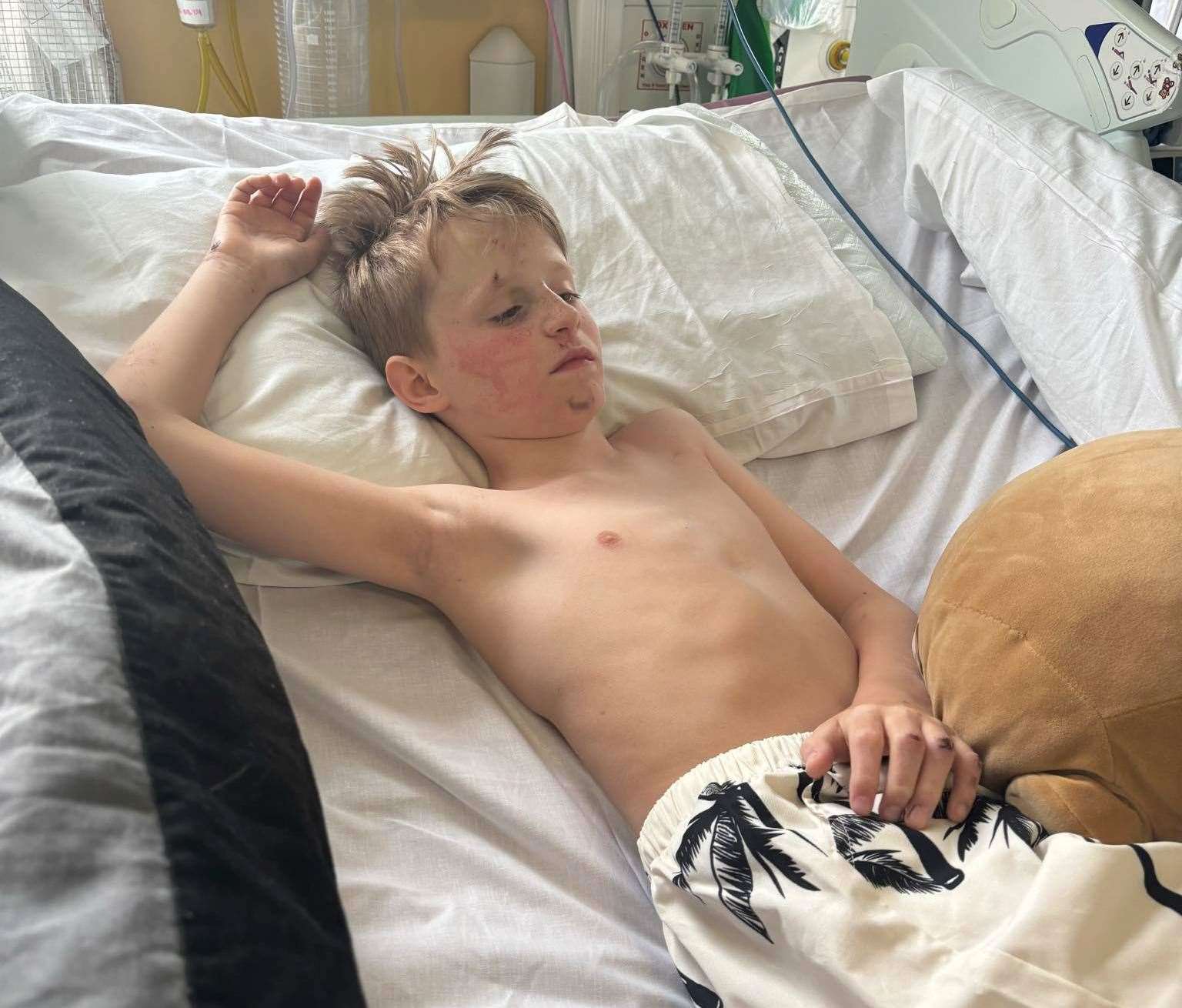 Harrison is being treated at Kings College Hospital in London. Picture: Kelly Sahlah