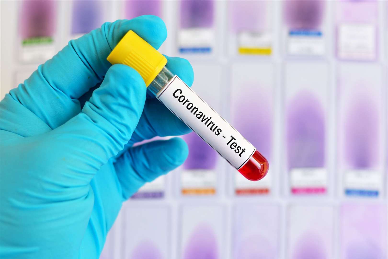 The coronavirus has caused events to be cancelled nationwide