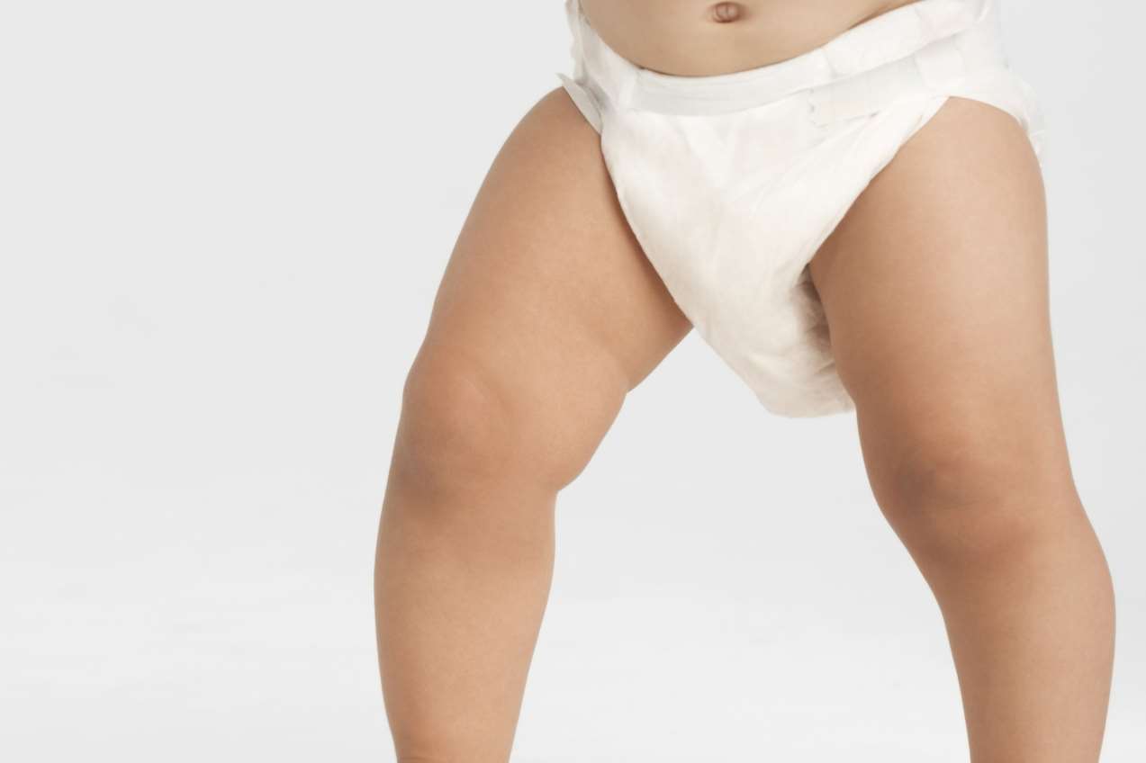 Children as old as 11 wearing nappies or pull-ups at night, Kent