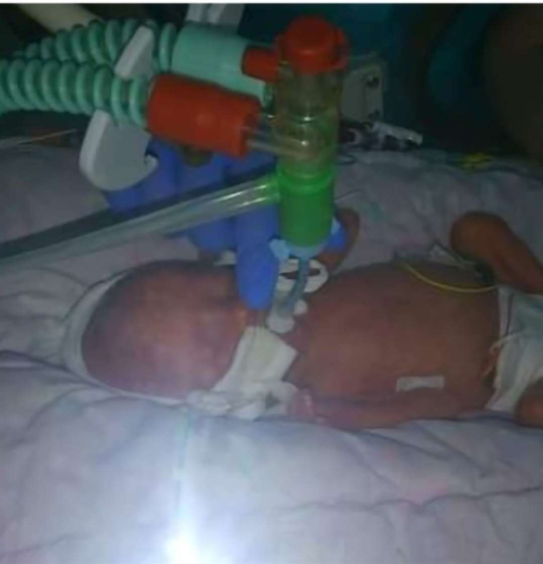 Reggie has global developmental delay because he was born prematurely