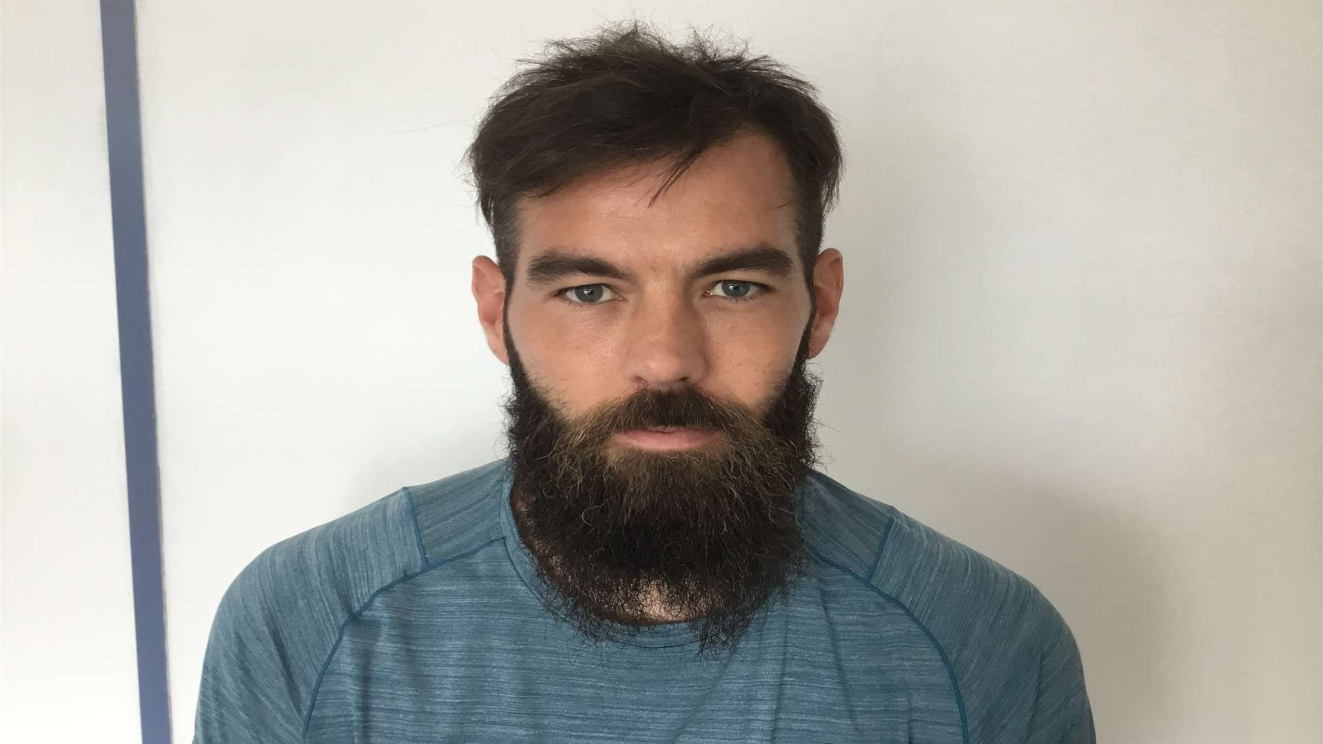 Wales midfielder Joe Ledley was treated at KSL Hair