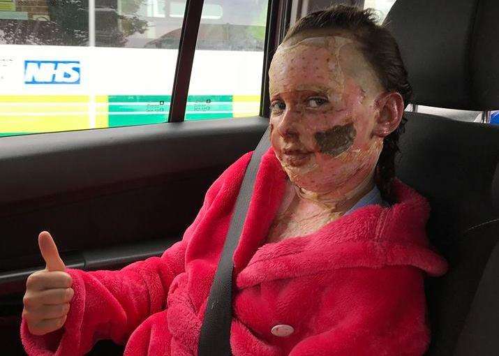 Jessie Symons travelling back from the hospital after suffering burns