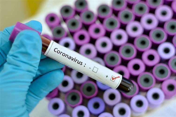 Coronavirus. Stock Image