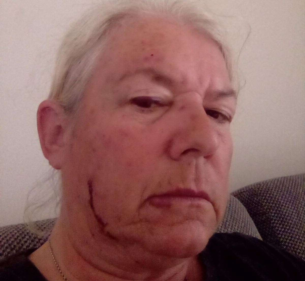 Karen Walker says she is 'scared to leave her home' after the attack in Pencester Gardens, Dover. Picture: Karen Walker