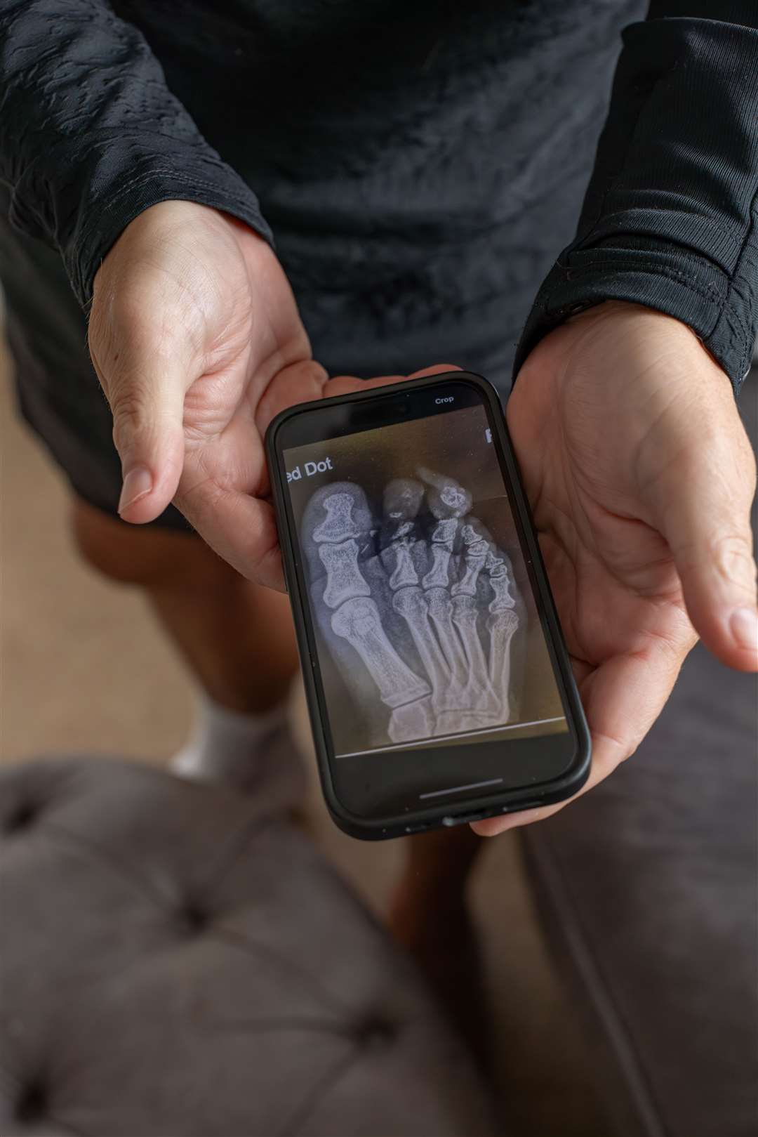 Brian Whitnall showing an X-ray image if his foot following an accident with a lawnmower. (RoSPA/Elizabeth Brown)