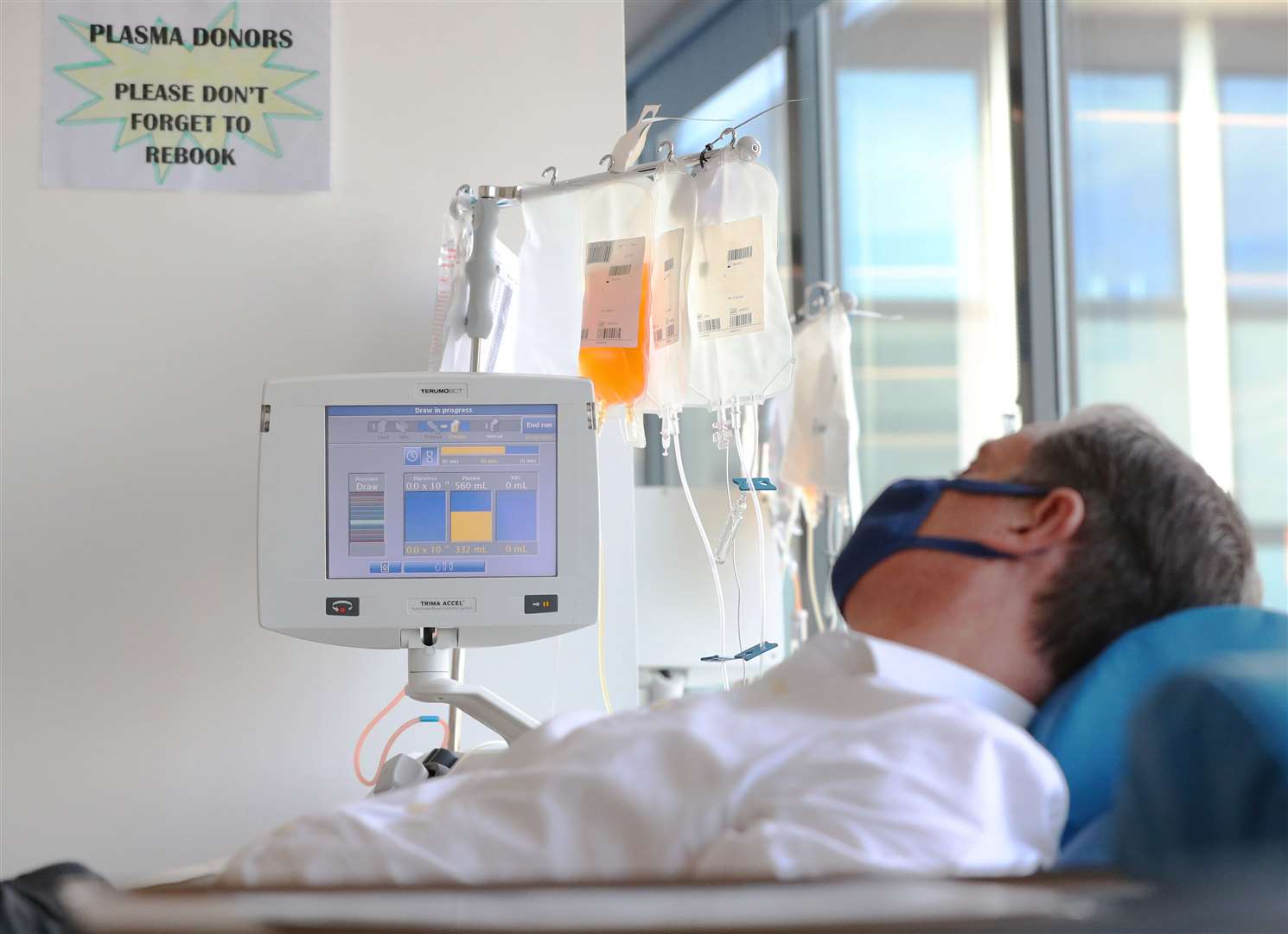 A donor is connected to an apheresis machine which separates plasma from blood (PA)