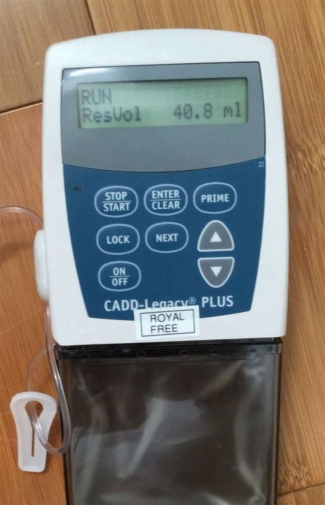 The pump used to control Yasmin's medication