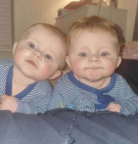 Billy and Sidney Todd require helmets, not funded by the NHS, to help correct the shape of their head