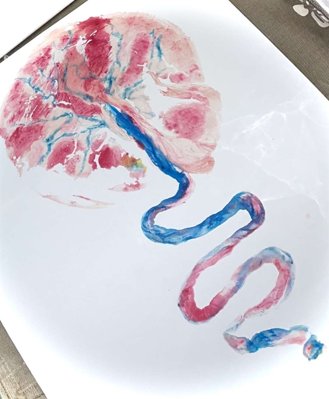 Emma also offers artwork prints of the placenta. Picture: Emma Legal