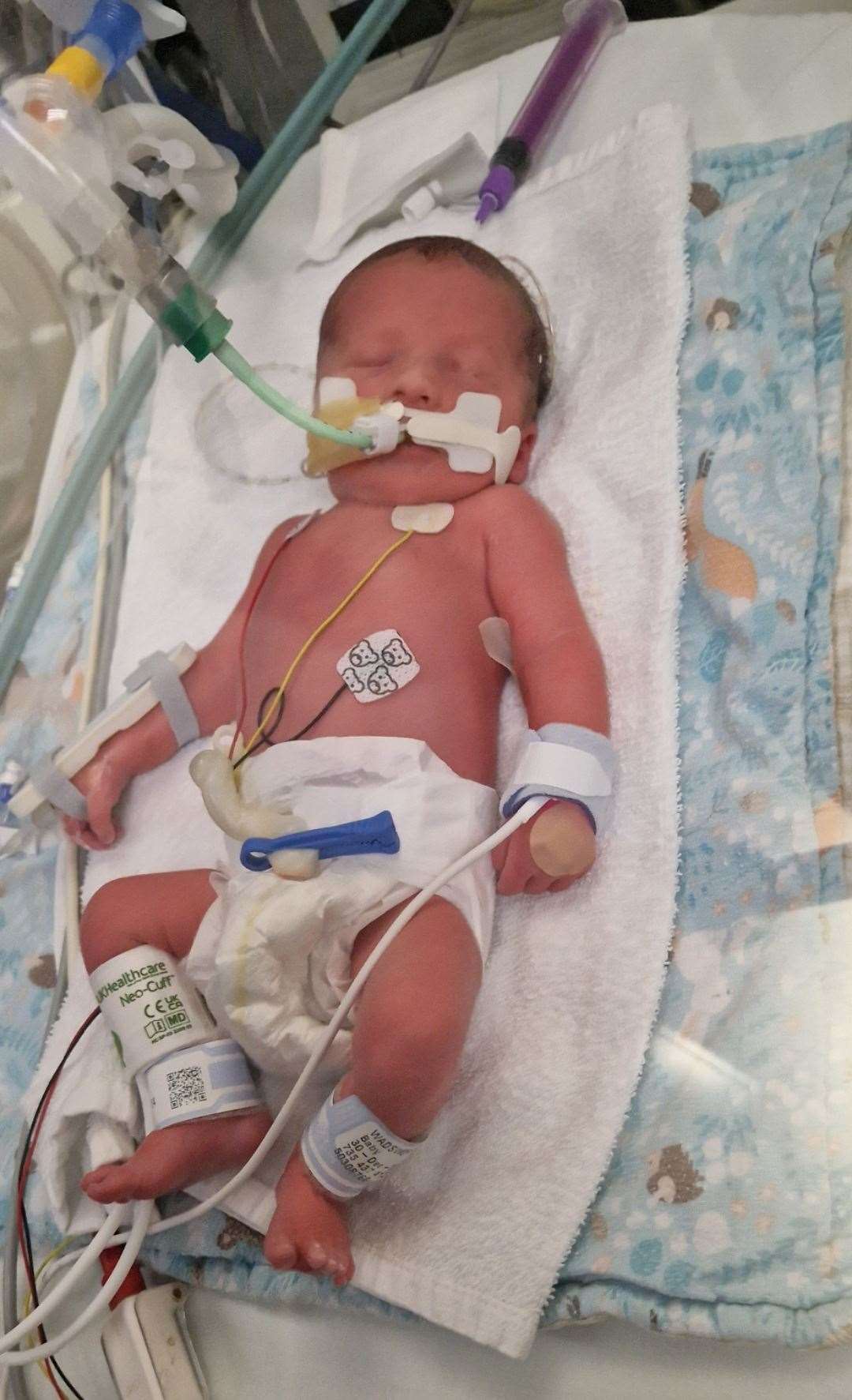 Little Albie is making good progress at the special care baby unit