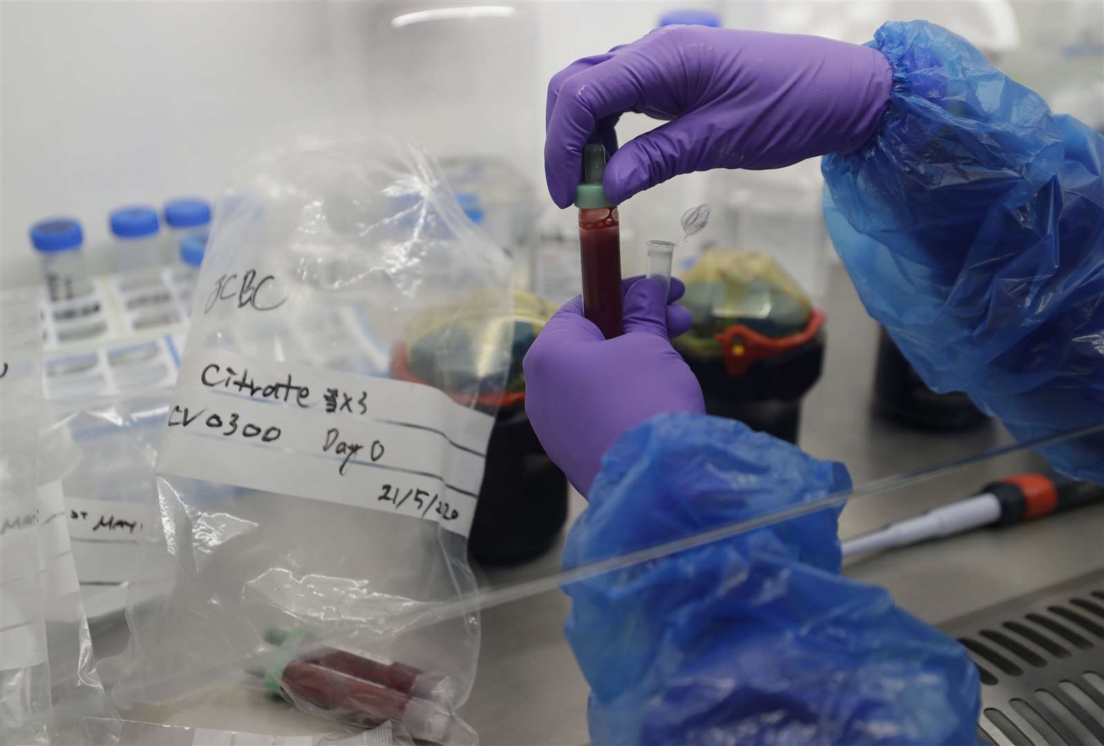 Blood samples from coronavirus patients (Kirsty Wrigglesworth/PA)