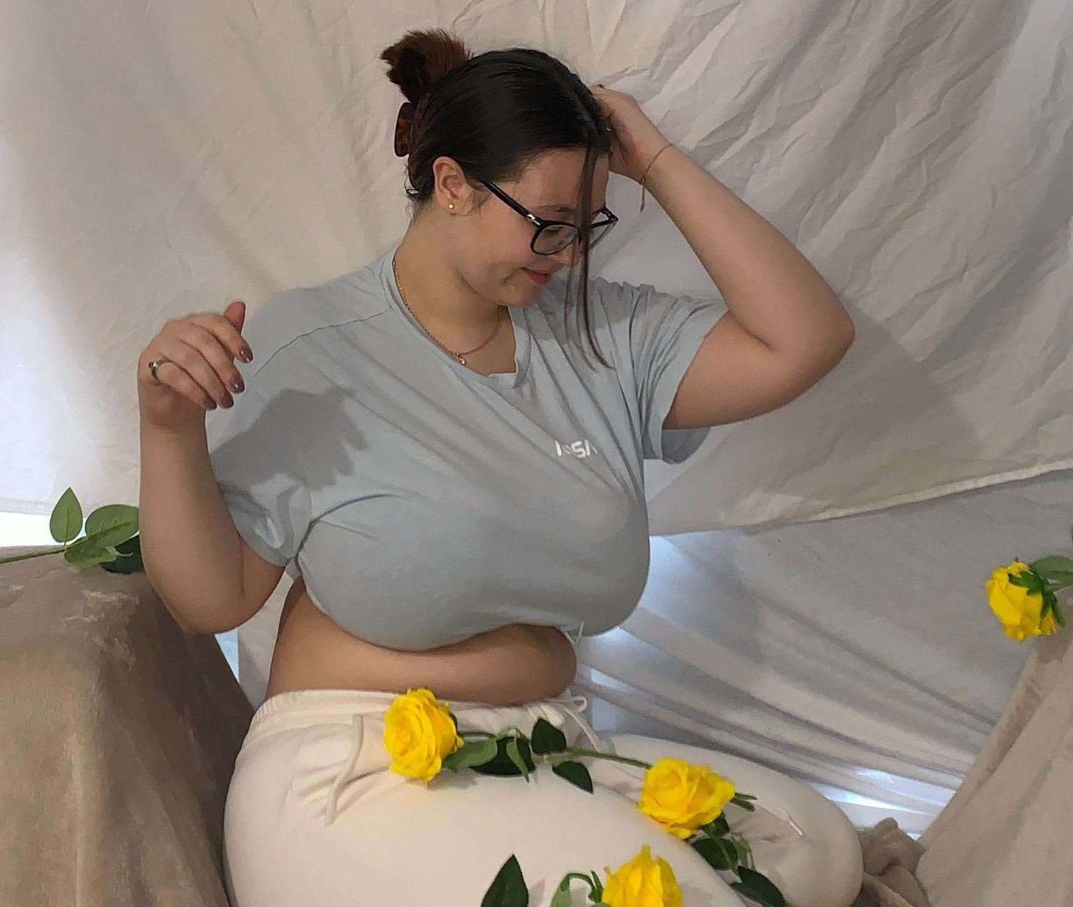 Mom, 23, who suffered from a CURVED spine due to 34E breasts undergoes  breast reduction surgery