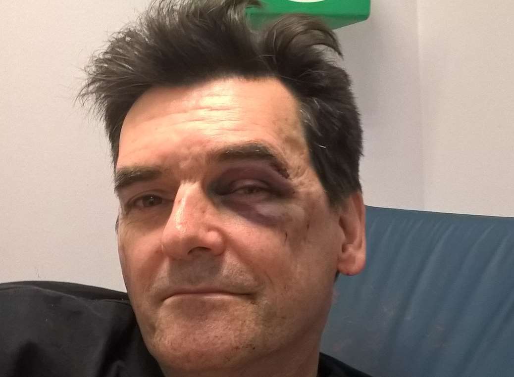 Tim Platt pictured in hospital after the attack